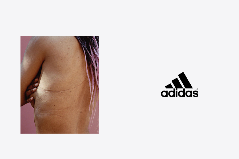 25 張裸胸照：Adidas 的全新廣告惹爭議，被指物化女性？
